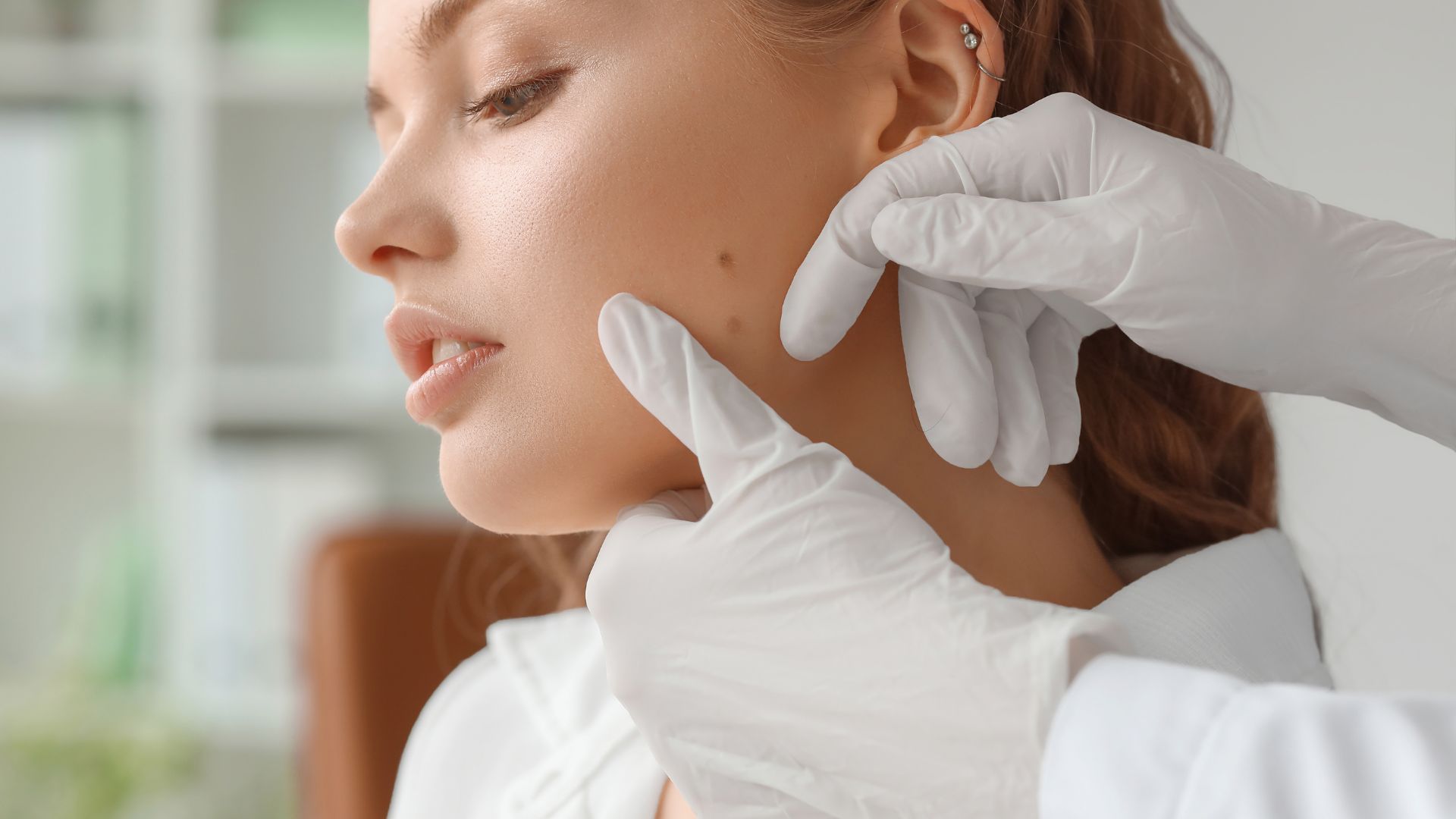 Marketing per dermatologi