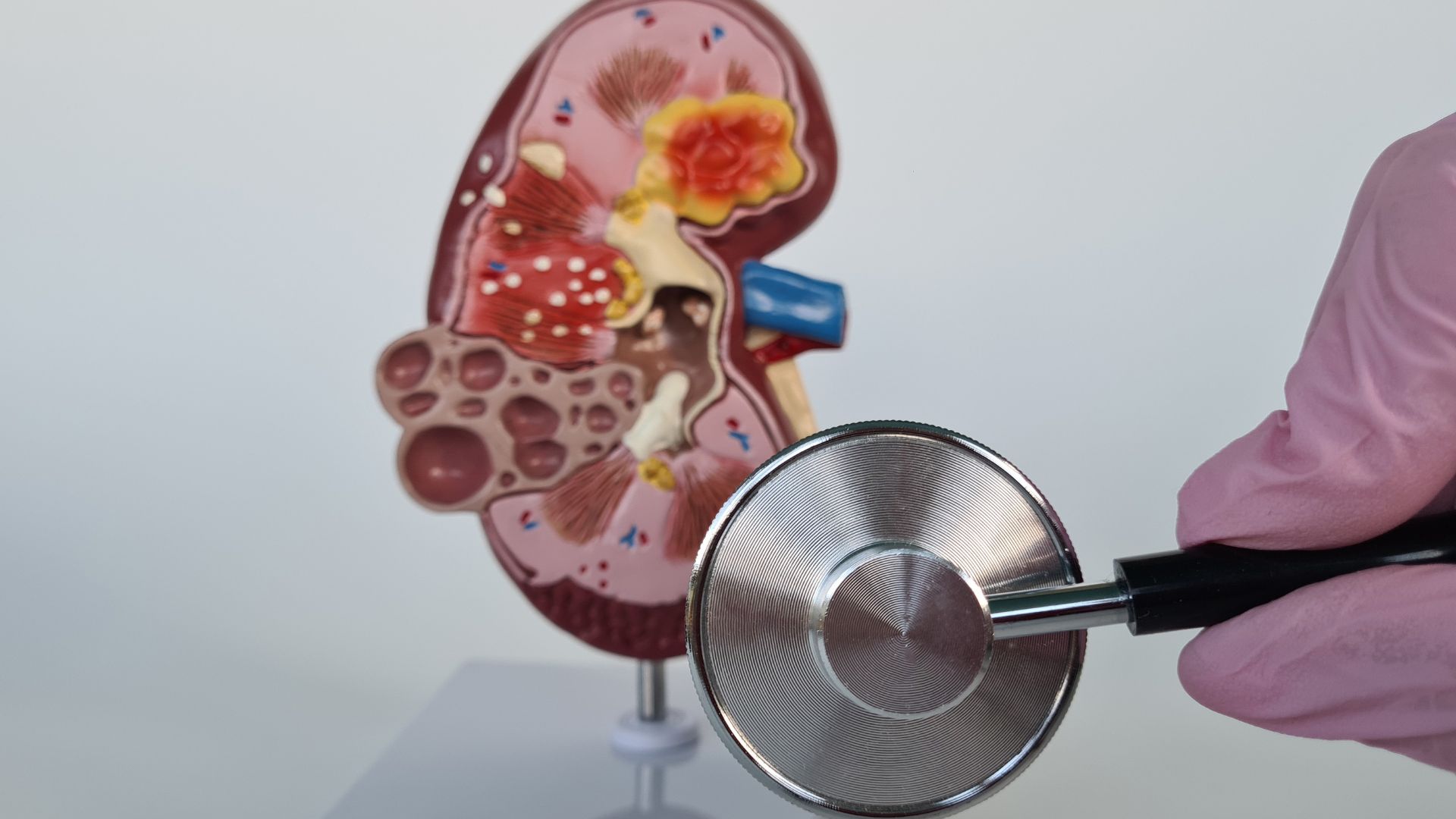 Marketing per urologi